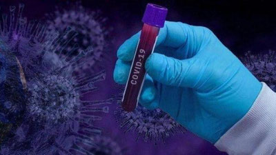 'Yana 103 kishida koronavirus aniqlandi, 196 bemor kasallikni engdi'ning rasmi