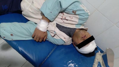 'Samarqandda fuqaro qo`shnisini o`roq bilan jarohatladi'ning rasmi