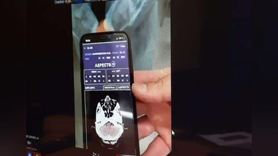 'Milliy palata: «Serebra» hayotni saqlab qolishda yordam beryapti'ning rasmi