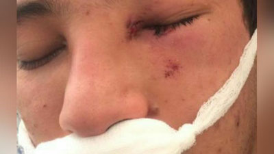 '22 yoshli yigit “Tashkent city” ishchilari tomonidan kaltaklandi'ning rasmi