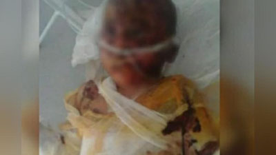 'Vazirlik Farg`onada qoshiqdan ko`zi shikastlangan bog`cha bolasi va Namanganda issiq suvdan kuyib vafot etgan bolakay hodisasi yuzasidan ma`lumot berdi (video)'ning rasmi