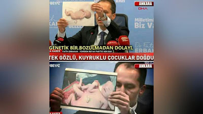 'Turkiyada emlangan onalardan dumlari va oyoq-qo`llari ko`p bo`lgan bolalar tug`ilayotgani haqidagi xabarlarga oydinlik kiritildi'ning rasmi