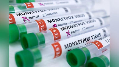 'Вазият жиддий: АҚШда маймунчечак юқтирганлар сони кескин ошди'ning rasmi