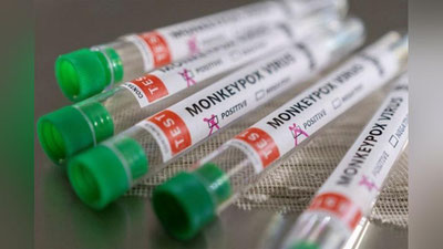 'Maymunchechak butun boshli AQShga tarqalib ulgurdi'ning rasmi