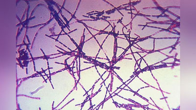 Изрображение 'В КЫРГЫЗСТАНЕ ГОСПИТАЛИЗИРОВАНЫ 12 ЧЕЛОВЕК С ПОДОЗРЕНИЕМ НА СИБИРСКУЮ ЯЗВУ'