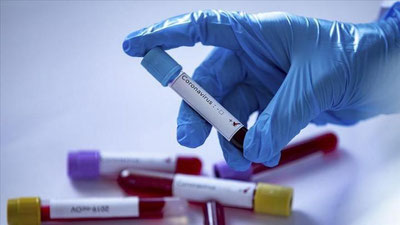 'O`zbekistonning to`rtta hududidan yana 118 kishida koronavirus aniqlandi'ning rasmi