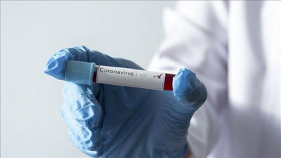 'O`zbekistonda yana 110 kishida virus aniqlandi. Kasallik aholi orasidan chiqishda davom etmoqda'ning rasmi