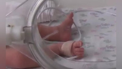 Изрображение 'Появление на свет сиамских близнецов в Самарканде: почему мать решилась на роды?'