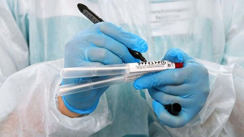 'Bugun bir kunda 318 kishida koronavirus aniqlandi'ning rasmi