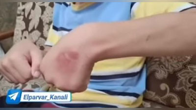 Изрображение 'В Андижанской области мать избивала и прижигала сына утюгом, заставляя его попрошайничать'