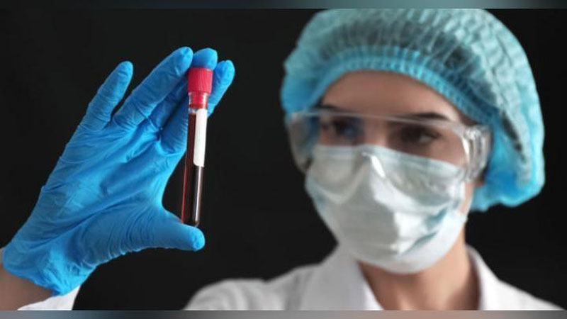 'O`zbekistonda koronavirus infeksiyasi rasman qayd etilgan holatlar 14085 (+92) tani tashkil qilmoqda'ning rasmi
