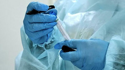'Коронавирусни даволашга йўналтирилган ҳар қандай муолажа илмий аслосланган бўлиши керак. Акс ҳолда...'ning rasmi