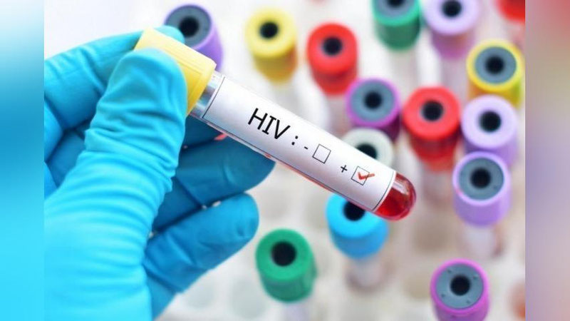 Изрображение 'На 2-х ВИЧ-инфицированных жителей Джизакской области завели уголовное дело'
