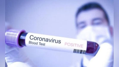 'Butun dunyoda koronavirus bilan kasallanganlar soni 80 mingdan oshdi'ning rasmi