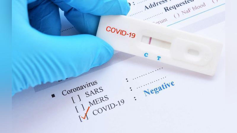 'Yana 173 nafar kishida koronavirus aniqlandi. Respublika bo`yicha kasallanganlar 34 701 nafarga etdi'ning rasmi
