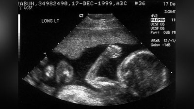 Изрображение 'Ученые США научились выбирать пол будущего ребенка'