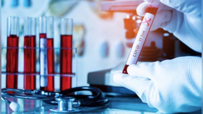 'Koronаvirus kimlarga umuman yuqmaydi?'ning rasmi