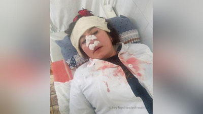 'Farg`onada hamshirani kaltaklaganlarga nisbatan jinoyat ishi qo`zg`atildi'ning rasmi