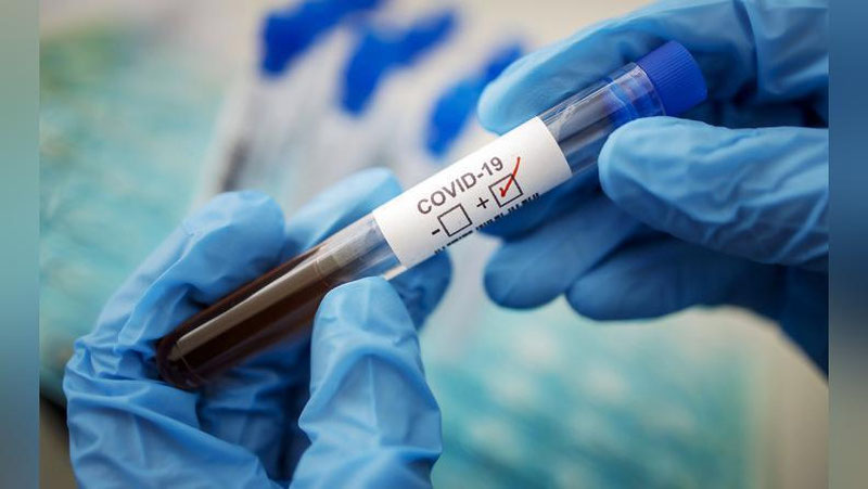 Изрображение 'Статистика COVID-19 в Узбекистане по итогам 26 сентября'