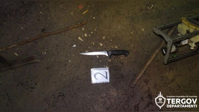 'Toshkentda 26 yoshli ayol o`z hamkasbini pichoqlab qo`ydi. Natijada...'ning rasmi