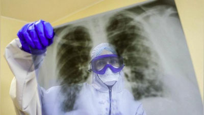 'Olimlar koronavirusning organizmda ko`payishini to`xtatuvchi fermentni aniqlashdi'ning rasmi