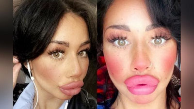 Изрображение 'БРИТАНКА ПОТРАТИЛА £1,5 ТЫСЯЧИ НА УВЕЛИЧЕНИЕ ГУБ'