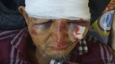 'Kirakash jurnal muxbirini kaltaklab, “o`ldi” degan gumonda Toshkent yaqinidagi dala chetidagi ariqqa tashlab ketishgan'ning rasmi