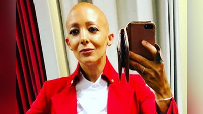 'Ikki farzandni dunyoga keltirgan ayol sochlaridan butunlay ayrildi 'ning rasmi