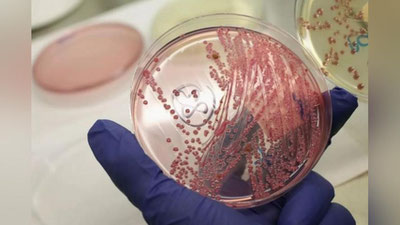 'Сирдарёда куйдирги касаллигининг аниқлангани ростми?'ning rasmi