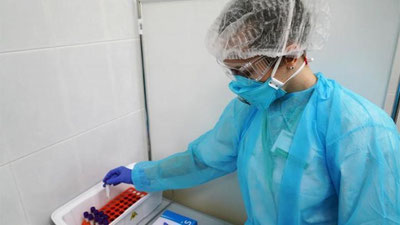 'Toshkent shahri va Toshkent viloyatidagi virusdan zararlanish statistikasi e`lon qilindi'ning rasmi