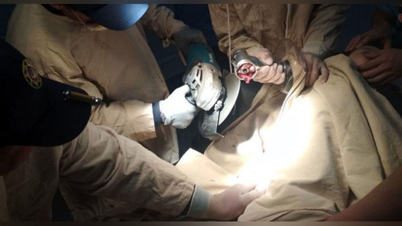 'FVV xodimlari 2 yashar bolaning qo`lini go`shtqiymalagichdan chiqarib olishdi 'ning rasmi