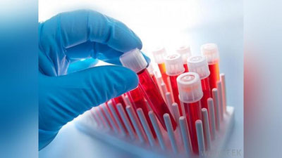 'O`zbekistonda gematologiya xizmatini rivojlantirish uchun 546,5 mlrd so`m va 70,7 mln dollar ajratiladi'ning rasmi