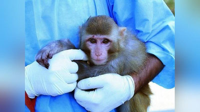 'АҚШ дунё мамлакатларини маймунчечакка қарши бирга курашишга чақиряпти'ning rasmi