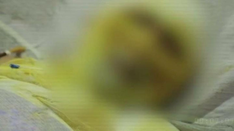 'Toshkentda erkak xotiniga jahl qilib, o`zini yoqib yubordi (video)'ning rasmi