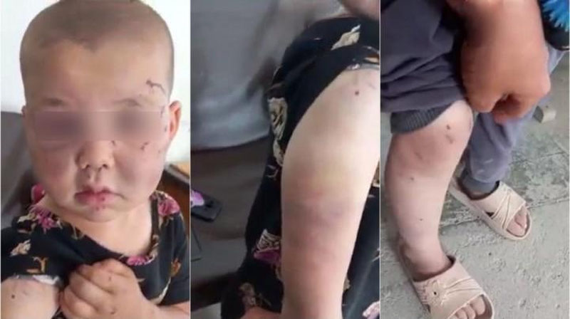 'Surxondaryoda kaltaklangan qizchaning buvisi nabirasi muntazam urib kelinganini aytdi (video)'ning rasmi