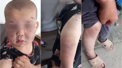 'Surxondaryoda kaltaklangan qizchaning buvisi nabirasi muntazam urib kelinganini aytdi (video)'ning rasmi