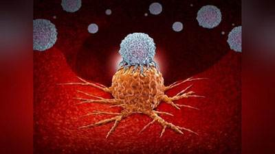 'Saraton yuzaga kelishining yangi sababi aniqlandi'ning rasmi