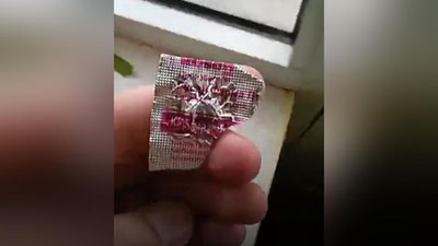 '“Karbamazepin” tabletkasining ichidan soch tolasi chiqdi'ning rasmi