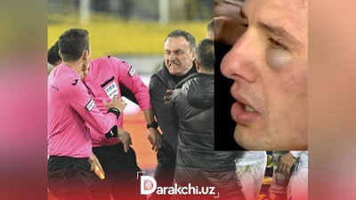 'Futbol bo`yicha Turkiya ichki chempionatida hakam kaltaklandi'ning rasmi