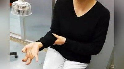 Изрображение 'У КИТАЯНКИ ПЕРЕСТАЛИ ГНУТЬСЯ ПАЛЬЦЫ ИЗ-ЗА ПОСТОЯННОГО ПОЛЬЗОВАНИЯ ТЕЛЕФОНОМ'