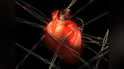 Изрображение 'МЕДИЦИНСКАЯ ИСТОРИЯ: ИНФАРКТ В 16 ЛЕТ'