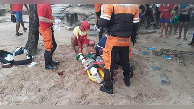 'Бразилияда наҳангбалиқ хужумидан сўнг сёрфингчи оёғидан айрилди (Видео)'ning rasmi