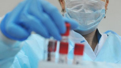 'Koronavirus: O`zbekistonda 13 fevral holati ma`lum qilindi'ning rasmi