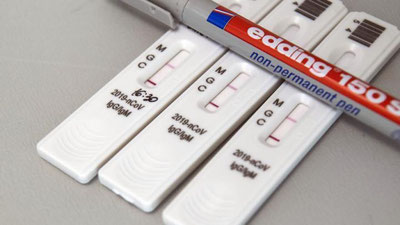 'COVID-19`ni engil o`tkazganlarda antitanachalar bo`lmaydimi?'ning rasmi