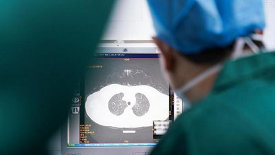 'Pnevmaniya: O`zbekistonda kunlik  ko`rsatgich 321 nafarni tashkil etmoqda'ning rasmi