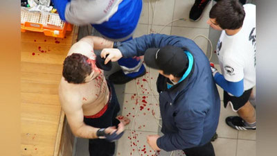 Изрображение 'КАК АБДУМАЛИК УЕХАЛ НА ЗАРАБОТКИ И ОСТАЛСЯ ... БЕЗ УШЕЙ'