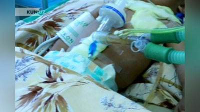 'Расмий хабар: танасидан 16та игна топилган чақалоқ тирик (фото)'ning rasmi