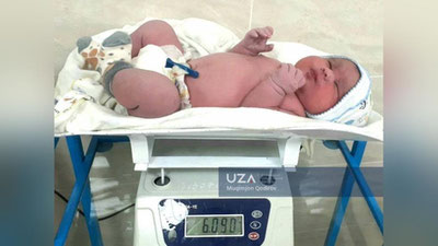 Изрображение 'В Фергане родился ребенок-богатырь весом в 6 кг'