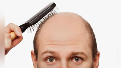 Изрображение 'ТОП-7 ПРИЧИН МУЖСКОГО ОБЛЫСЕНИЯ'