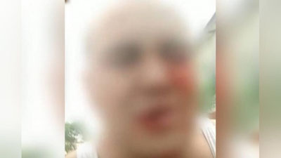 'Surxondaryoda mahalla raisi fuqaroni urib, ko`z pardasini yirtib yubordi (video)'ning rasmi